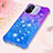 Funda Silicona Carcasa Goma Bling-Bling S02 para Xiaomi Redmi 11A 4G