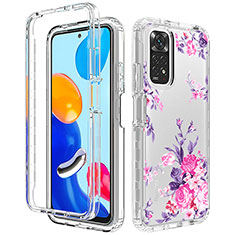 Funda Silicona Carcasa Ultrafina Transparente Goma Frontal y Trasera 360 Grados para Xiaomi Redmi Note 11S 4G Rosa