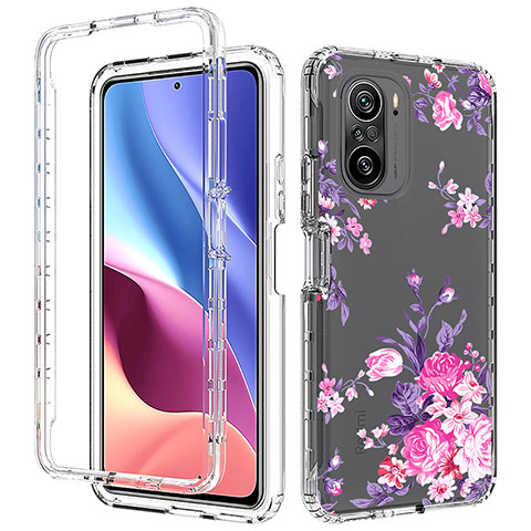 Funda Silicona Carcasa Ultrafina Transparente Goma Frontal y Trasera 360 Grados para Xiaomi Mi 11X 5G Rosa